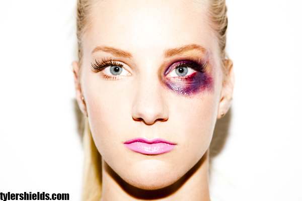 Closeup of Heather Morris with a painted-on black eye