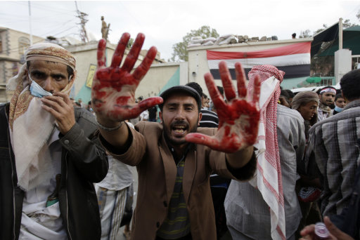 An anti-government protester holds out his blood-stained hands after clashes with security forces, in Sanaa, Yemen, Sunday, Sept. 18, 2011. Yemeni government forces opened fire with anti-aircraft guns and automatic weapons on tens of thousands of anti-government protesters in the capital pushing for ouster of longtime ruler Ali Abdullah Saleh, killing several people and wounding dozens.(AP Photo/Hani Mohammed)