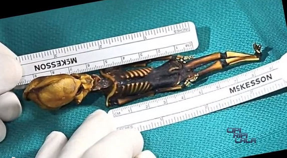 1. A 6-inch-long (15 centimeters) skeleton was found in the Atacama Desert in Chile. The skeleton showed several anomalies, including its alienlike skull, teensy body and the fact that it had just 10 ribs rather than the 12 that healthy humans