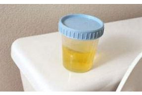 Yuk, Prediksi Kesehatan dari Warna Urine