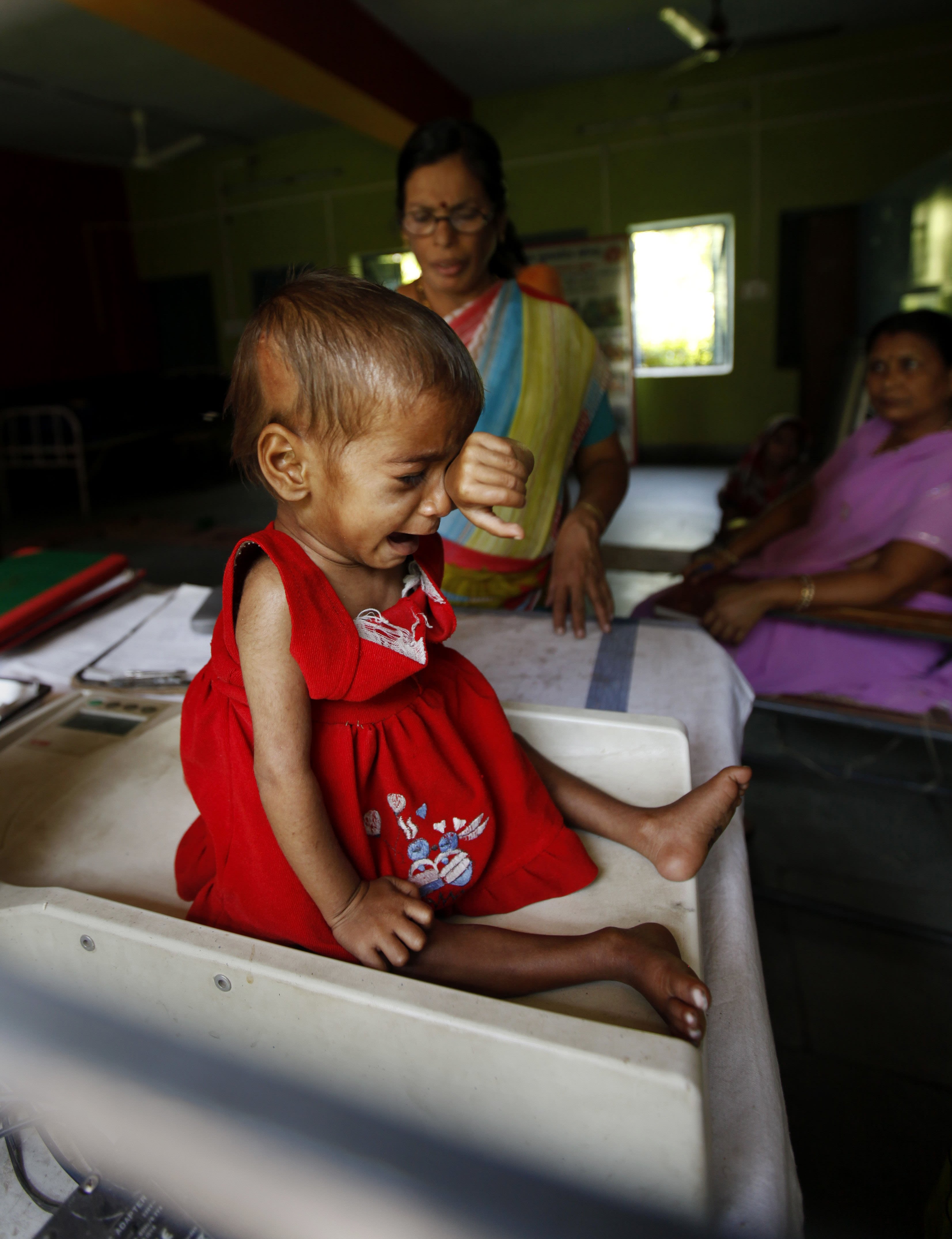 Sania, una niña de un año y nueve meses de edad, llora mientras se registra que su peso es de apenas 5 kilogramos (11 libras) en un centro para niños desnutridos en Morena, India, el miércoles 13 de abril de 2011. (Foto AP/Mustafa Quraishi)