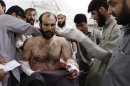 A man who was injured in a bomb blast during an election campaign rally of the Jamiat Ulema-e-Islam religious party, receives treatment at a hospital in Peshawar