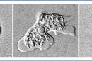 This combo of images provided by the Center for Disease Control shows the Naegleria fowleri amoeba in the cyst stage, left, trophozoite stage, center and the flagellated stage, right. The Louisiana Department of Health and Hospitals on Thursday tried to dispel common 
