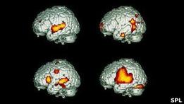 علماء يسجلون الكلمات في الدماغ قبل ان تنطق  120201142413_brain_304x171_spl