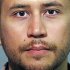Warning Graphic Photo: Possible New Evidence Shows George Zimmerman's Bloodied Head