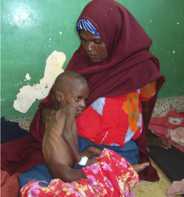 Foto-Foto Kelaparan di Somalia