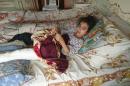 A handout picture taken by a family member and released by Amnesty International on August 13, 2016 shows Syrian Ghina Ahmad Wadi resting at her home in Madaya after being shot in the leg