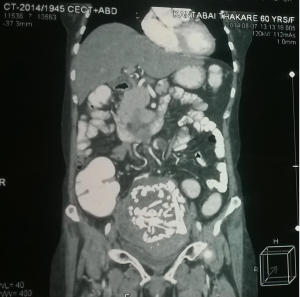 Photo of a CT scan showing the skeleton of a                  foetus&nbsp;&hellip;