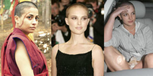 Female Celebrities Who Went Bald