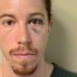 Olympian Shaun White Arrested, Charged With Vandalism
