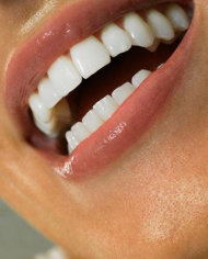 كيف تحصلين على أسنان ناصعة البياض 1Teeth-jpg_073200