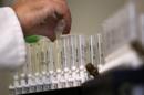 FILE - In this Feb. 5, 2010 file photo, a laboratory technician prepares samples of urine for doping tests during a media open day, at the King's College London Drug Control Centre, London. The world's anti-doping authority is launching an 