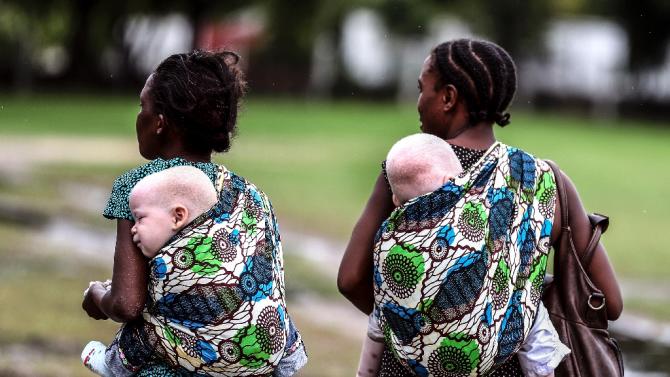 Women carrying their albino children on May 5, 2014, in Dar es Salaam