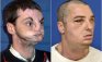 Combination of handout pictures released by the University of Maryland Medical Center shows Richard Norris before and after his face transplant surgery