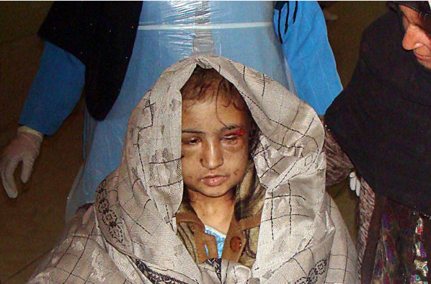 In this Wednesday, Dec. 28, 2011 file photo, 15-year-old Sahar Gul, is carried into hospital in Baghlan north of Kabul, Afghanistan. According to officials in northeastern Baghlan province, Gul's in-l