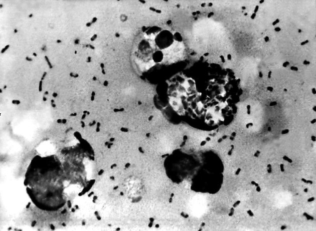 Imagem obtida em janeiro de 2003 mostra bactéria da peste bubônica extraída de paciente