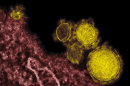 This undated electron microscope image made availalbe by the National Institute of Allergy and Infections Diseases - Rocky Mountain Laboratories shows novel coronavirus particles, also known as the MERS virus, colorized in yellow. The mysterious new respiratory virus that originated in the Middle East spreads easily between people and appears more deadly than SARS, doctors reported Wednesday, June 19, 2013 after investigating the biggest outbreak in Saudi Arabia. (AP Photo/NIAID - RML)