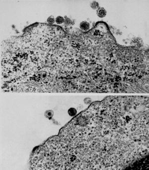 FILE - This combination made from file photos provided by the National Institute of Health, Pasteur Institute shows, at top, a form of human T-cell leukemia virus, or HTLV, discovered by U.S. Dr. Robert Gallo and his team at the National Cancer Institute, a division of the National Institute of Health in Bethesda, Md. The image at bottom shows a lymphadenopathy-associated virus, or LAV, discovered by French Dr. Luc Montagnier of the Pasteur Institute. Both Gallo and Montagnier are credited with isolating the HIV virus that causes AIDS, or the human immunodeficiency virus. The discovery was announced 30 years ago, on April 23, 1984, at a news conference in Washington. (AP Photo/National Institute of Health, Pasteur Institute, File)