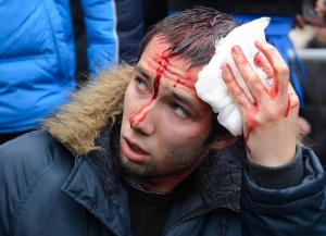 A wounded pro-Western activist sits after clashes with …