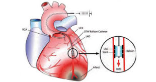  الهواء البارد يشكل خطراً على مرضى القلب  Smal10201028134524