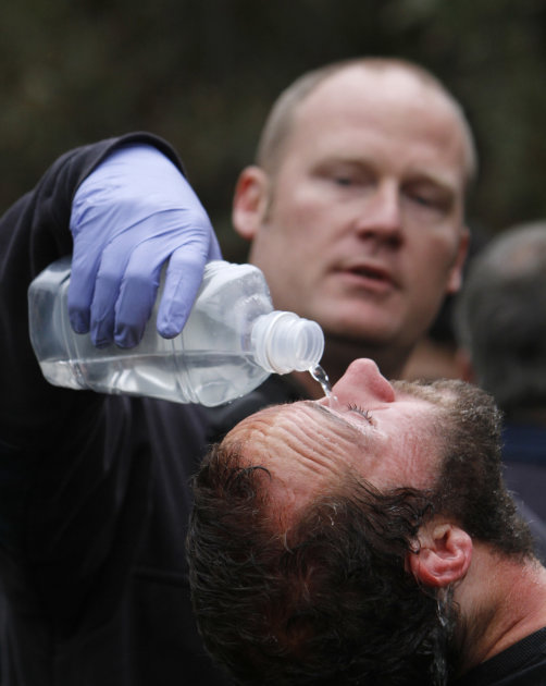 University of California, Davis, student Mike Fetterman, receives a  treatment for pepper spray by UC Davis firefighter Nate Potter, after campus police dismantled an Occupy Wall Street encampment on 