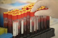 Una médico organiza muestras de sangre recolectadas para hacer la prueba del VIH/sida. EFE/Archivo