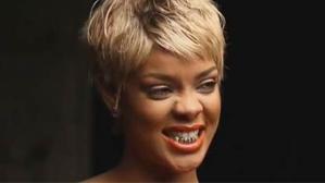 Rihanna Gets Kanye Like Teeth...Shows Off Golden Grill 3