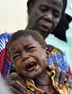 A child with noma disease cries at the health centre &hellip;