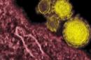 CDC BACKTRACKS ON MERS REPORT