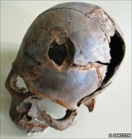 Descubren restos de una gran batalla de la Edad de Bronce Craneodelaedaddebronceencontradojuntoalrio