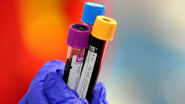 Studies show the blood tests could potentially offer a non-invasive method of showing whether a woman has cervical cancer