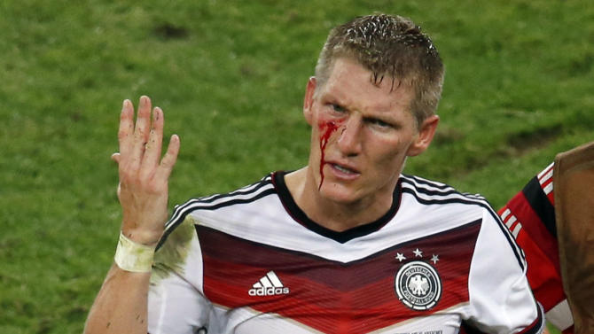 23 injury photos that prove soccer is not for the weak