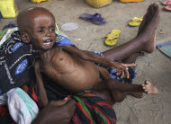A malnourished child from southern Somalia cries on his mother's lap, at a refugee camp in Mogadishu, Somala, The United Nations says famine will probably spread to all of southern Somalia within a month and force tens of thousands more people to flee into the capital of Mogadishu.(AP Photo/Farah Abdi Warsameh)