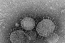 Un hombre infectado con el coronavirus muere en Francia