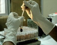 (Arquivo) Técnico testa amostras de sangue em um laboratório