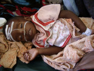 A malnourished child from southern Somalia lies on a bed at Banadir hospital in Mogadishu, Somalia, Tuesday, Aug. 2, 2011. The United Nations says famine will probably spread to all of southern Somalia within a month and force tens of thousands more people to flee into the capital of Mogadishu. (AP Photo/Farah Abdi Warsameh)