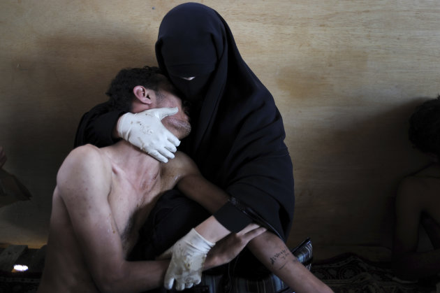 In this photo provided on Friday Feb. 10, 2012 by World Press Photo, the 2012 World Press Photo of the year by Samuel Aranda, Spain, for The New York Times, shows a woman holding a wounded relative during protests against president Saleh in Sanaa, Yemen, Oct. 15, 2011. (AP Photo/Samuel Aranda/New York Times)