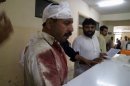 A man, who was injured in a blast, stands at a hospital in Parachinar