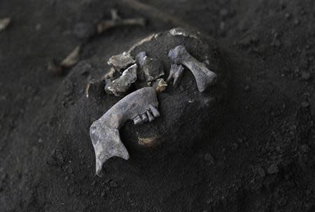 Fragments of a human skull are seen at a construction site in the former war zone in Mannar