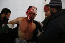 Medics treat a man who was wounded in an air strike by Syrian government forces on Hammuriyeh in the rebel-held region of Eastern Ghouta on December 24, 2015