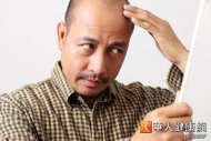 在台灣每2名男性中，就有1人面臨掉髮、頭皮發癢、頭皮屑增多，以及禿髮等4大危機。