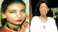 Acid Attack Victim Fakhra Yunus Commits Suicide (ABC News)