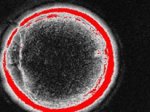 Cientistas clonam célula-tronco humana