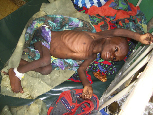 Foto-Foto Kelaparan di Somalia