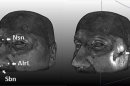 5 Face-Shaping Genes Identified