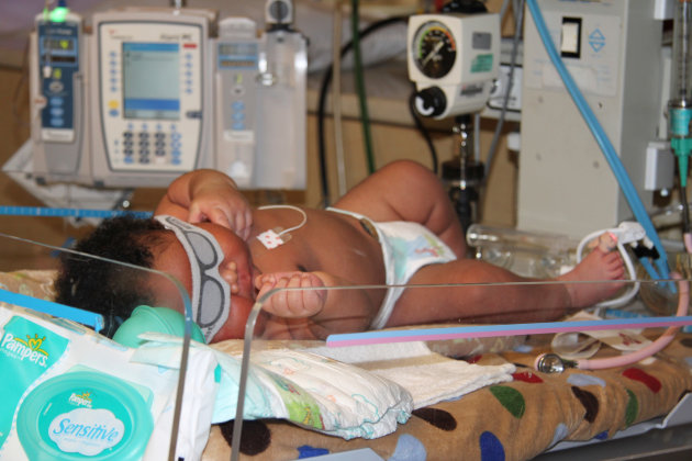 This photo provided by Good Shepherd Medical Center Marketing Department shows JaMichael Brown Monday, July 11, 2011, in the hospital's neonatal care unit in Longview, Texas. Janet Johnson gave birth 