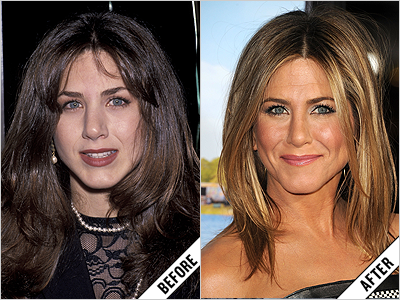 nose jennifer aniston job before jobs celebs had celebrity green after who rachel plastic dailymakeover upton thread surgery friends makeover