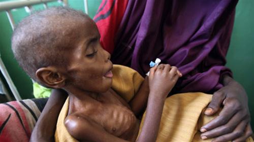 Đông Phi đói khủng khiếp ThumbnailID_511099
