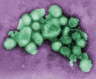 New Swine Flu Virus Shows Lethal Signs