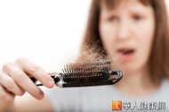 國內女性掉髮患者後來居上，近10年人數增加了2.5倍。